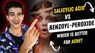 Benzoyl Peroxide vs Salicylic acid For Acne  Benzoyl Peroxide  Salicylic Acid [upl. by Elyak]