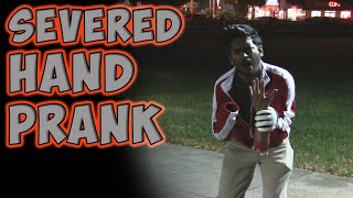 Severed Hand Prank [upl. by Winnah696]