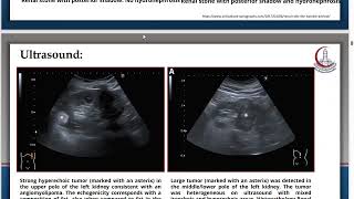 Clinical Genitourinary Module  Radiology amp Andrology [upl. by Clemen]