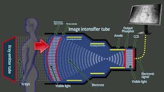 Fluoroscopy  Xray intensifier tube  Basic functions [upl. by Tarsuss912]