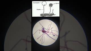 Rhizopus slide under MicroscopeMicroorganism [upl. by Cupo]