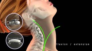 Mobi C short animation clip movement in the neck [upl. by Soren]