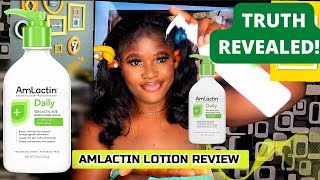 Amlactin Lotion Review Watch this before buying What Amlactin did to my skin Amlactin skincare [upl. by Einavoj]