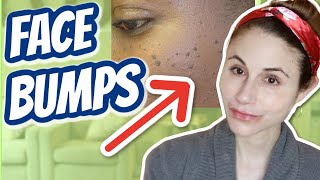 How to get rid of bumps on the face Dr Dray [upl. by Mahalia275]