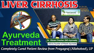 Liver Cirrhosis Ayurveda Treatment  Completely Cured Patient Review from Prayagraj Allahabad UP [upl. by Neahs]