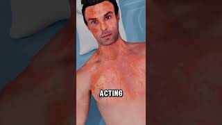 LifeSaving EpiPen Moment During Severe Allergy Attack ⚠️💉viralvideo 3danimation [upl. by Doykos]