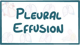 Pleural Effusion  causes symptoms diagnosis treatment pathology [upl. by Rosol]