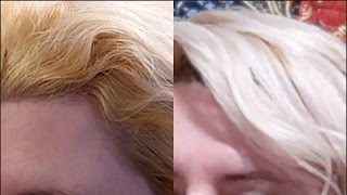 How can I use orange for hair growth [upl. by Thibault562]