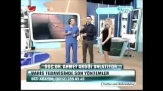 DVT  Varis damarı tıkanıklığı  tedavisi  Prof Dr Ahmet AKGÜL [upl. by Clayborn]