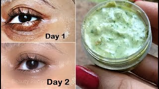 in 5 Days Remove Under Eye Wrinkles Dark Circles Under Eye Bags with Potato Eye Mask [upl. by Edwine129]