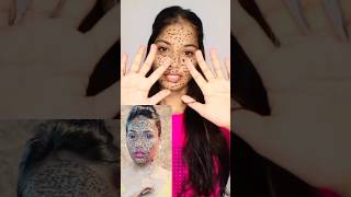 Henna freckles😰 challenge😭 mehndishorts hack youtubeshorts makeuphackviralhacks [upl. by Esidnac]