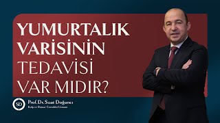 Yumurtalık Varisinin Tedavisi Var Mıdır [upl. by Elocyn]