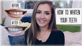 HISMILE TEETH WHITENING KIT REVIEW  Mel Joy [upl. by Skiest]