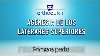 AGENESIA DE LOS LATERALES SUPERIORES PRIMERA PARTE [upl. by Orji925]