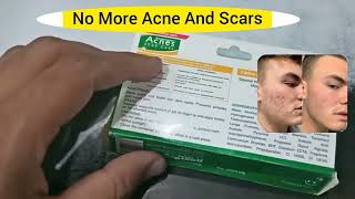 quotACNES SCAR CARE GEL FOR ACNES AND SCARSquot [upl. by Chae]