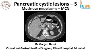 Mucinous cystic neoplasm of pancreas  Pancreatic cystic neoplasms part 5  Edusurg Clinics [upl. by Spooner707]