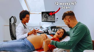 12 Weeks Anomaly Scan  Nuchal Translucency Scan [upl. by Henryk417]