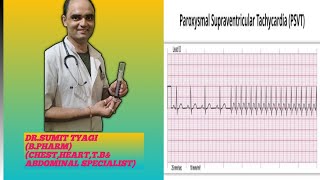 PAROXYMAL SUPERVENTRICULAR TRACHYCARDIA BY DRSUMIT TYAGISUMITMEDICALDISPENSARY1 [upl. by Roehm]