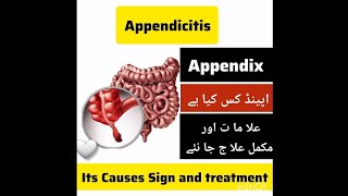 Appendix painappendicitis causescomplicationsdiagnostic test and treatmentviralvideomedical [upl. by Auohp]