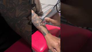 Hand small tattoo removal part 1 tattooartshorts [upl. by Stedmann808]