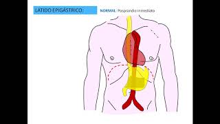 Latido epigástrico pptx [upl. by Timmie883]