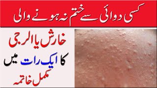 Kharash الرجی ka fori ilaj Top 3 Natural Remedies You Need to Try [upl. by Niatsirhc]