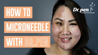 How to microneedle at home with Dr Pen  Dr Pen Australia  Microneedling  Skin Needling  CIT [upl. by Asil]