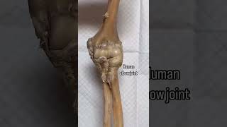 HUMAN ELBOW JOINT  Anatomy  Surgery  medical animation anatomy [upl. by Arlee64]