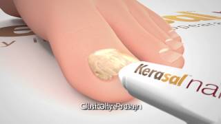 Kerasal Nail Restore Healthy Nail Appearance 30 Sec [upl. by Lehsar]