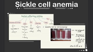 Sickle Cell Anemia  Pathology  Full Revision with Easy Notes [upl. by Triplett]