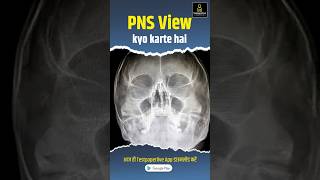 PNS View Xray  Pns view kyo karte hai  pns xray xraytechnicians pnsview drtclasses shorts [upl. by Neddy433]