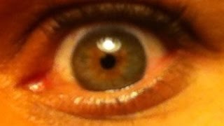 This Is my Eye Central Heterochromia amp What your Eye Color Says About You [upl. by Ellocin]