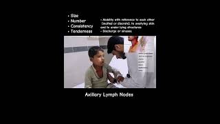 Axillary Lypmh Nodes Palpation axillary lymphnodes lymph malignancy cancer breastcancer wards [upl. by Remmos]