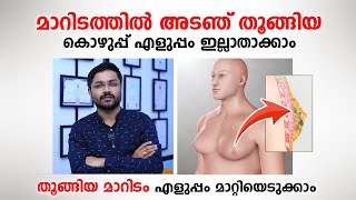 മാറിടത്തിൽ അടഞ് തൂങ്ങിയ കൊഴുപ്പ് എളുപ്പം ഇല്ലാതാക്കാം  Dr Prajwal K Rao [upl. by Eesdnyl]