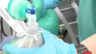 How does a Propofol injection work Dr Sanjay Gupta and Dr Raphael Gershon on CNN [upl. by Hackney]