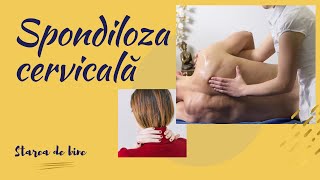 Spondiloza cervicala si hernia de disc cervicala  Starea de bine [upl. by Aicelaf]