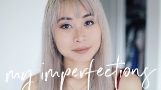 My Perfect Imperfections Tag  Biggest Flaws amp Insecurities [upl. by Mahan350]