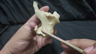 Maxilla anatomy easy bangla demonstration by Dr Fahad DMC [upl. by Ezaria]