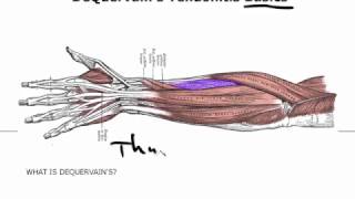 De Quervain Tendonitis Basics Like Its Just Thumb Tendonitis [upl. by Nealson]