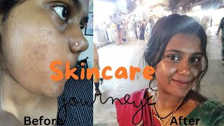 MY SKINCARE TRANSFORMATION🌷PHARMACY PRODUCTS👀Clinmiskinahaglow [upl. by Adnohryt]