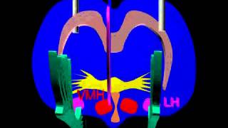 The impact of LH lesions on the nigrostriatal pathway [upl. by Lyndon]