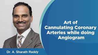 Art of Cannulating Coronary Arteries while doing Angiogram  Medicover Hospitals [upl. by Enneiviv806]