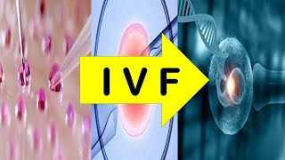 InVitroFertilization IVF Process [upl. by Baird]