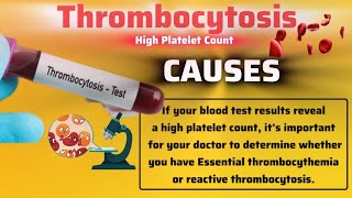 THROMBOCYTOSIS OR High Platelet Count  Cause  Symptoms  Complications  Treatment [upl. by Saleem]