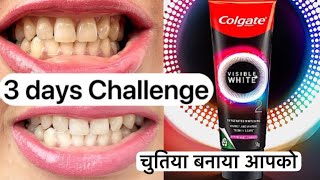 Colgate Visible White 02 Toothpaste Review Get Whiter Teeth in 3 Days Exposed [upl. by Flanna203]