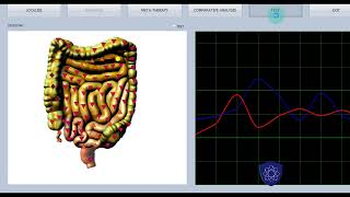 Introducing Bioresonance Technology What is Bioresonance Technology [upl. by Edrahc725]