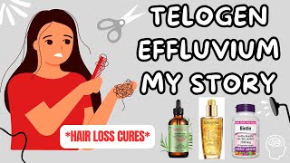 Telogen Effluvium Recovery  REGROWTH TIPS [upl. by Yhcir]