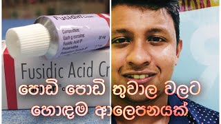 Fusidic Acid Cream  පොඩි පොඩි තුවාල වලට හොදම ආලෙපයක් [upl. by Judus610]