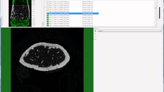 Bruker microCT tutorial Setting the trabecular VOI for the mouse femur [upl. by Fanny]