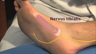 Motorische Neurographie  Tibialis [upl. by Fleta112]